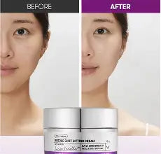 VT Reedle Shot Lifting Cream